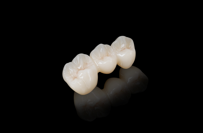 Mono-Block Zirconia